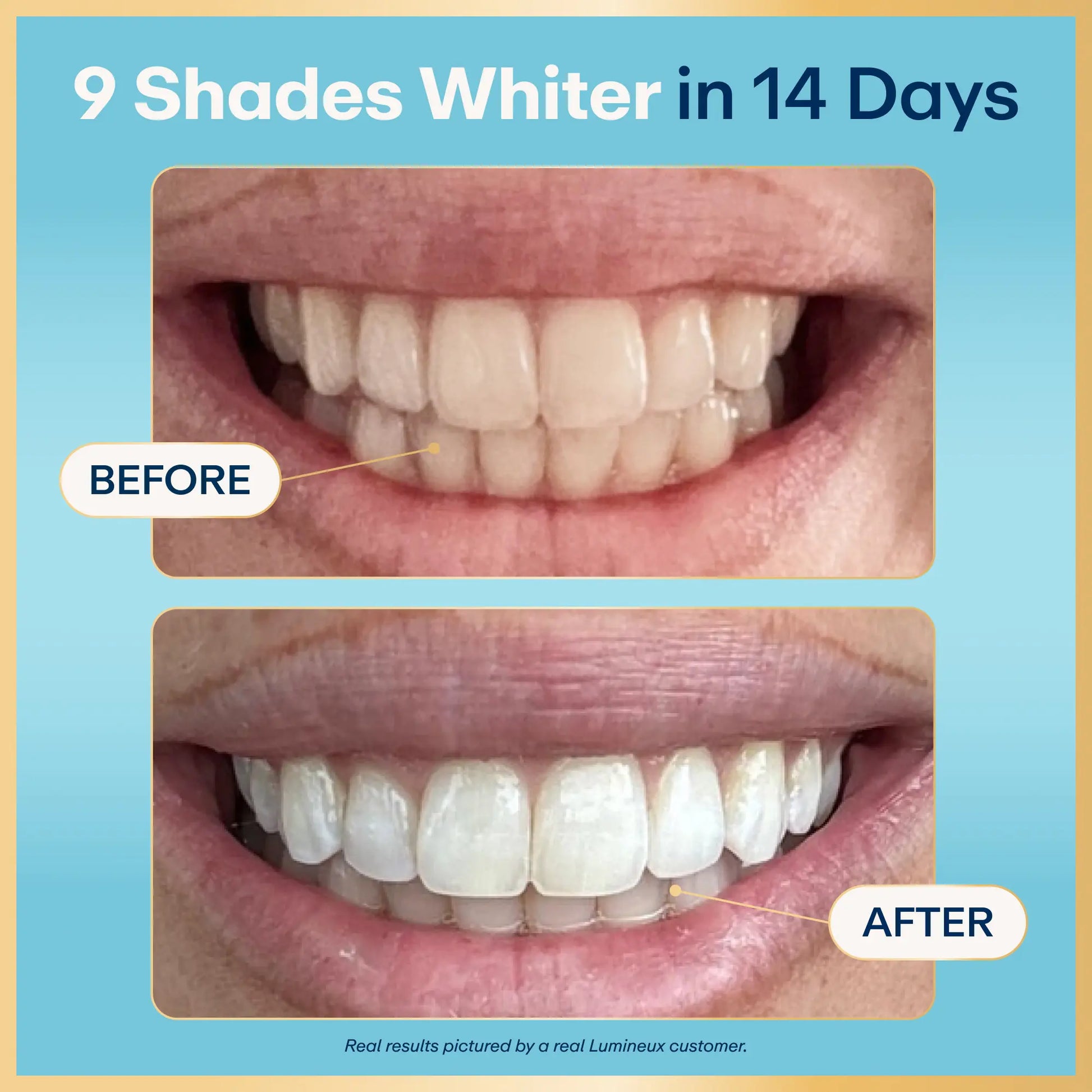 Lumineux Mineral Salt Whitening Strips 9 Treatments or 21 Treatments - Peroxide Free - Enamel Safe for Whiter Teeth - Whitening without the Sensitivity - Dentist Formulated - Sensitivity